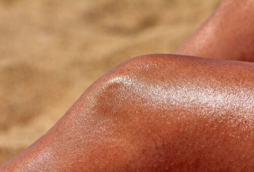 The Cellular Battlefield: What a Sunburn Actually Does to Your Skin