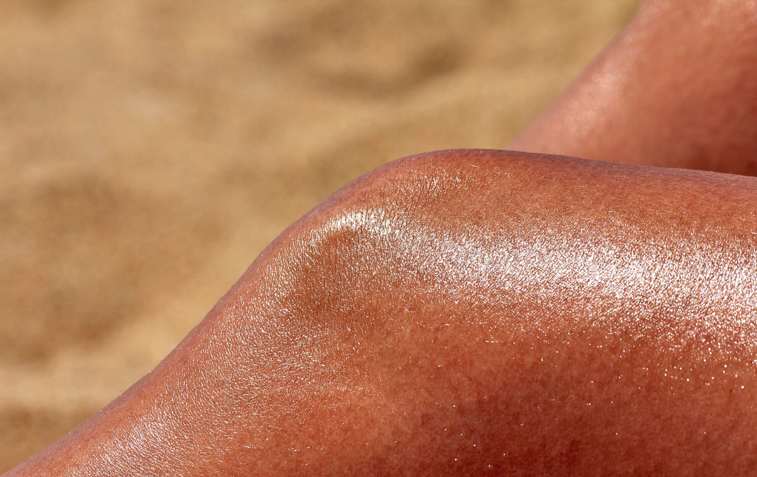 The Cellular Battlefield: What a Sunburn Actually Does to Your Skin