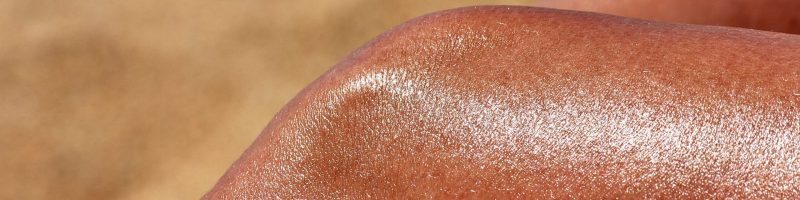 The Cellular Battlefield: What a Sunburn Actually Does to Your Skin