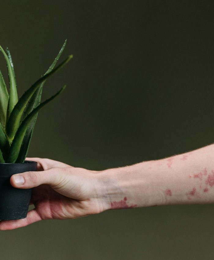 Soothing Stressed Skin: Natural Remedies for Calm and Balance