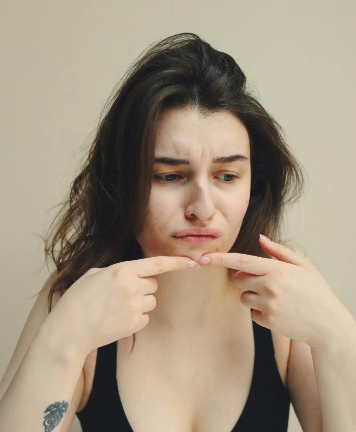 The Mind–Skin Connection: How Stress Shows Up on Your Face